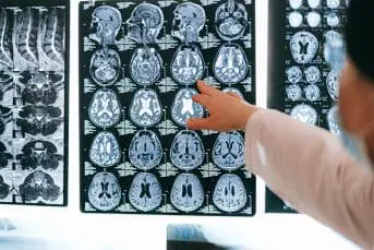 brain injury and bladder